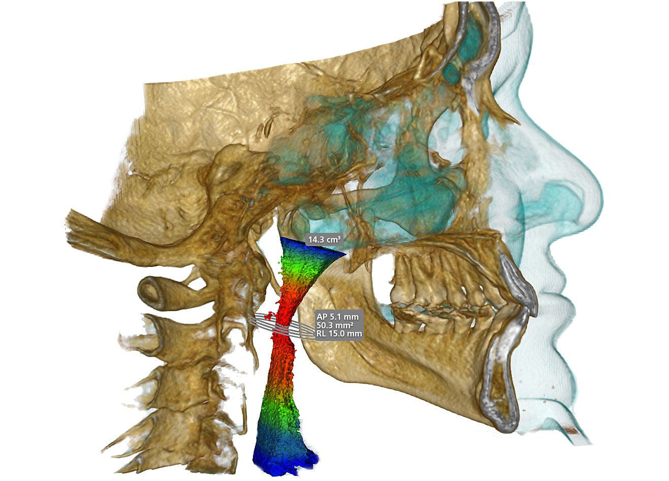 cbct 3d airway scan in odessa FL