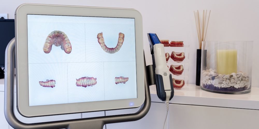 Dental 3d scanner monitor in the dentist's office. Snapshot of the clean and empty dental office. The interior of the modern dental clinic. Samples of artificial mouths with brackets
