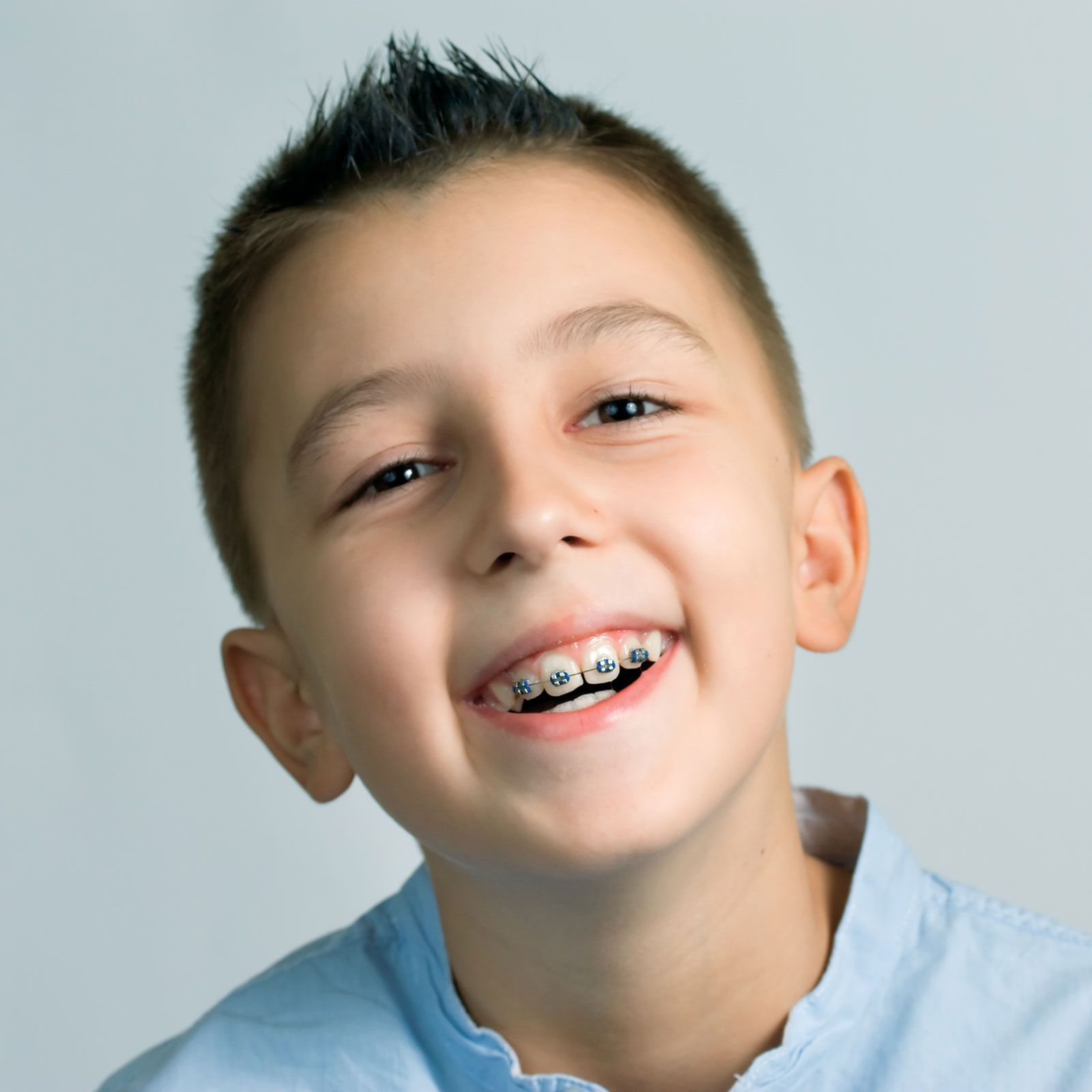 problems early treatment addresses smile isle orthodontics